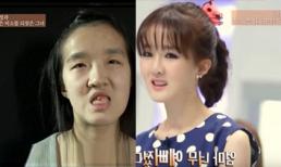  Cô gái khiến chồng 'không nhận ra' vì phẫu thuật thẩm mỹ quá đẹp