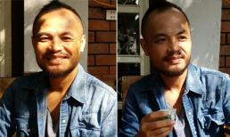 Trần Lập tươi rói sau ca phẫu thuật ung thư đại trực tràng