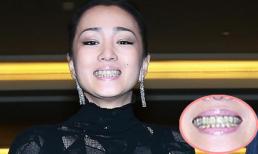 Củng Lợi lộ hàm răng mất điểm 'toàn tập'