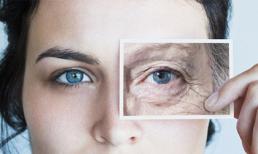 Xóa hết nhăn - Đánh tan bọng mỡ mắt chỉ trong 90 phút