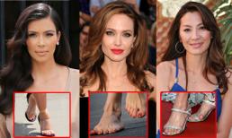 10 ngôi sao nổi tiếng thế giới có bàn chân xấu tệ