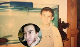 Ảnh thời thơ ấu khác 'một trời một vực' của chàng trai dao kéo 'mặt rắn'