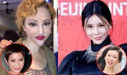 Những sao châu Á ngày càng xấu vì phẫu thuật thẩm mỹ