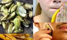 7 lợi ích tuyệt vời của vỏ chuối