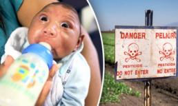 Bộ Y tế xác nhận 9.500kg hóa chất nghi gây teo não ở trẻ đã được nhập về Việt Nam