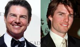 Tom Cruise dính nghi án phẫu thuật thẩm mỹ khiến mặt biến dạng