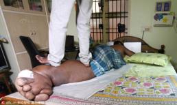 Người đàn ông có bàn chân khổng lồ như voi