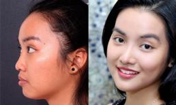 Hot girl 9X kiếm được việc làm sau khi sửa mũi, độn cằm