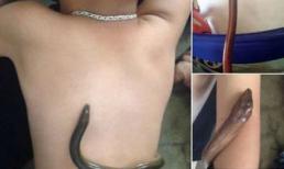 Dùng lươn sống chườm hạ sốt cho trẻ: Cực kỳ nguy hiểm!