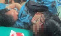 Xúc động với hình ảnh người mẹ bị tai nạn vẫn gắng cho con bú