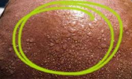 Thiếu Vitamin D và những hiểm họa khôn lường với cơ thể