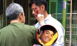 Xôn xao ảnh Quách Tuấn An bị đánh bê bết máu ở Sài Gòn