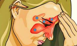 Chữa viêm xoang cực đơn giản và hiệu quả với giấm táo