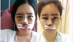 Hình ảnh phẫu thuật thẩm mỹ đau đớn của thiếu nữ Hàn
