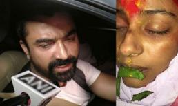 Nghi án 'Cô dâu 8 tuổi' bị sát hại vì xuất hiện nhiều vết bầm tím trên mặt