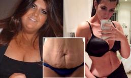 Cô gái giảm 83 kg vì phải mua 2 chỗ trên máy bay