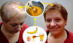 Công thức thúc đẩy mọc tóc nhanh