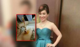 Đi phẫu thuật thẩm mỹ bị bác sĩ để quên băng gạc trong bụng