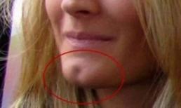 Người có lúm đồng tiền cằm sẽ nói lên tính cách gì?