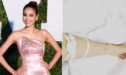 Bệnh cũ của Phạm Hương tái phát do ăn uống thất thường