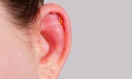 Top 10 hiệu quả chữa nhiễm trùng tai