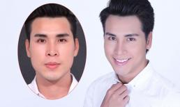 Gặp siêu mẫu cao 1m82 sửa mũi để 'giữ tiền'