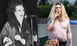 Khuôn mặt đáng sợ của ca sĩ nghiện 'dao kéo' Pete Burns