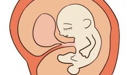 Cảnh báo tư thế mẹ bầu ảnh hưởng tới con