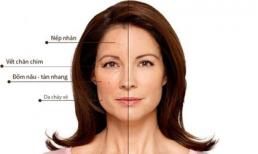 Botosonic HIFU - Nâng cơ trẻ hóa da một lần duy nhất