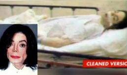 Hình ảnh khám nghiệm tử thi của các sao thế giới gây ám ảnh