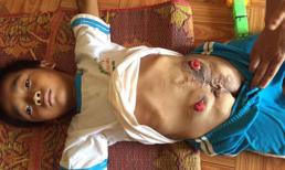 Đau lòng trước hình ảnh em bé không có hậu môn, bộ phận sinh dục