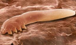  Loài rận chuyên ký sinh trên da mặt người