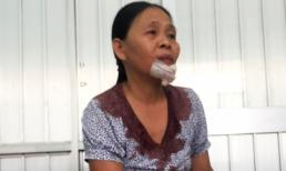 Lời kể kinh hoàng của nạn nhân sống sót trong vụ TNGT thảm khốc