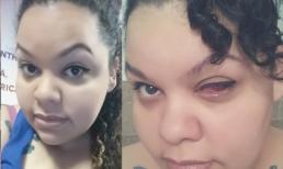 Cô gái bị mù vì trang điểm mắt