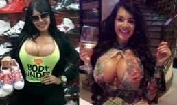 Vòng một như sắp 'nổ tung' của cô nàng nghiện thẩm mỹ