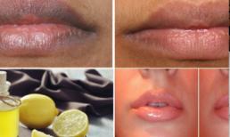 Môi hết thâm và ửng hồng với công thức tự nhiên