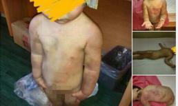 Cha nhẫn tâm đánh đập con gái rồi gửi ảnh đe dọa vợ cũ