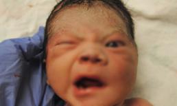 Cảnh báo: Trẻ bị méo mồm, liệt mặt do nằm phòng điều hòa liên tục