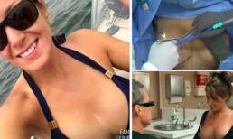 Phẫu thuật thẩm mỹ hỏng, cô gái Mỹ bị dính hai bầu ngực vào nhau