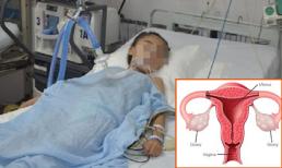 Bé gái 10 tuổi phải cắt bỏ 1 buồng trứng chỉ vì mẹ nghĩ con bị đau bụng thông thường