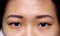 Nhận biết người hay gặp vận xui qua tướng mặt 