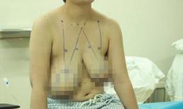 Ngực mất cân đối do cho con bú sai cách