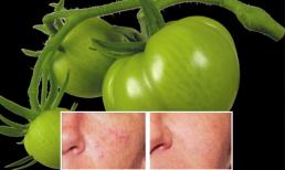 Cách chữa giãn mao mạch ở mặt