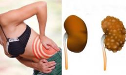 5 thói quen đang làm hư hỏng thận mà bạn không biết