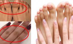 Các vùng khớp tay đen mấy cũng trắng bóc với thành phần tự nhiên