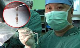 Loại bỏ sán dây dài 7,5cm trong não của bé 10 tuổi