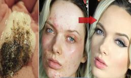 Công thức làm đẹp kỳ diệu từ hạt tiêu đen