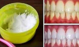 Làm thế nào để làm trắng răng tại nhà trong 3 phút: kết quả 100%