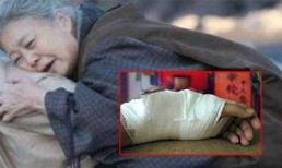 Bị mẹ chồng đánh gãy tay, con dâu vẫn cố cõng bà vượt 3 km trong đêm đến viện cấp cứu