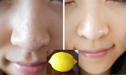  Lấy sạch mụn đầu đen chỉ với một quả chanh